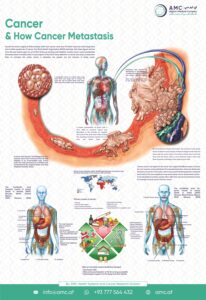 Cancer and How Cancer Metastasis? 