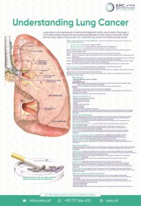 Understanding Lung Cancer 