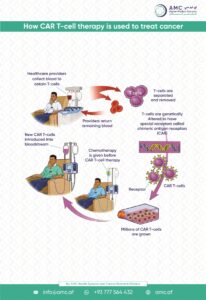 Car T-Cell therapy