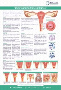 Cervical Cancer