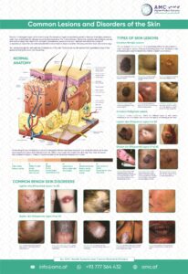 Skin Health: Lesions & Disorders