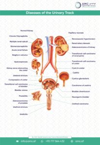 Diseases of the Urinary Track