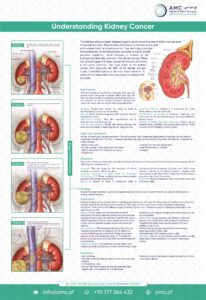 Kidney Cancer