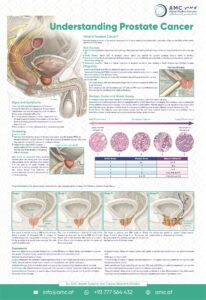 Understanding Prostate Cancer