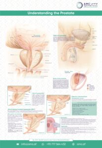 Understanding the prostate