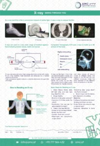 X-ray Post Design